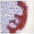 Immunohistochemistry-Paraffin: 14-3-3 sigma Antibody [NBP1-74557] - Human skin stained with Msx14.3.3 sigma at 1:50